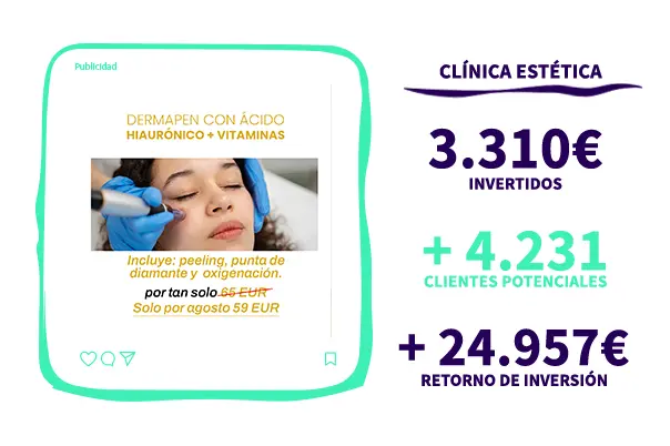 Retorno de inversion (ROI) En centros mÃƒÂ©dicos estÃƒÂ©ticos en madrid , Pulso Marketing para estÃƒÂ©ticas