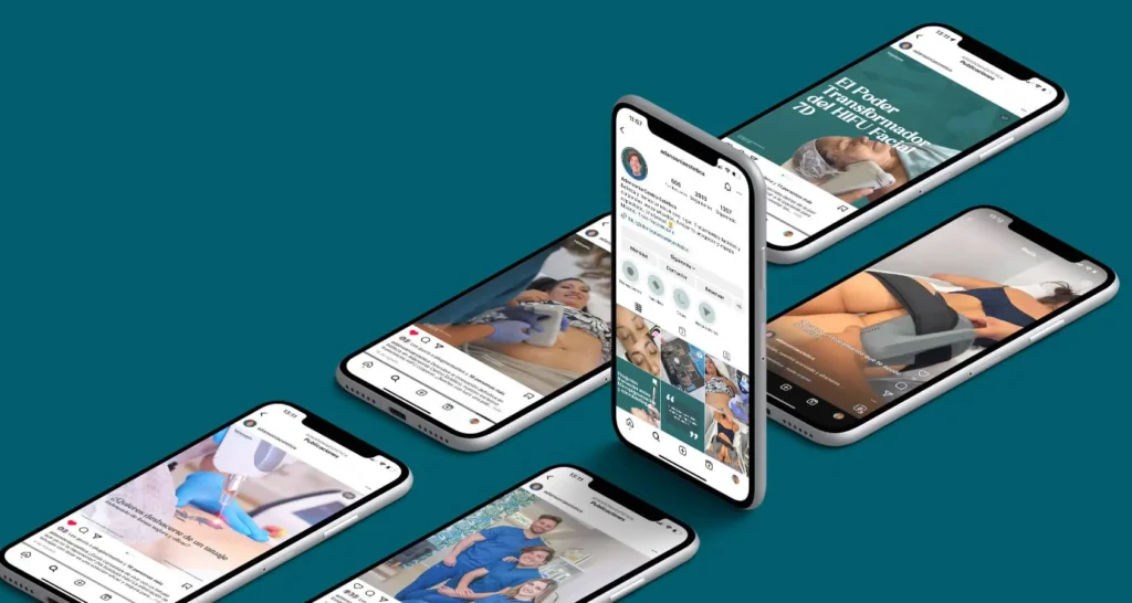 MÃƒÂºltiples telÃƒÂ©fonos mÃƒÂ³viles mostrando el perfil de Instagram de Adansonia Centro EstÃƒÂ©tico y sus publicaciones sobre tratamientos estÃƒÂ©ticos.